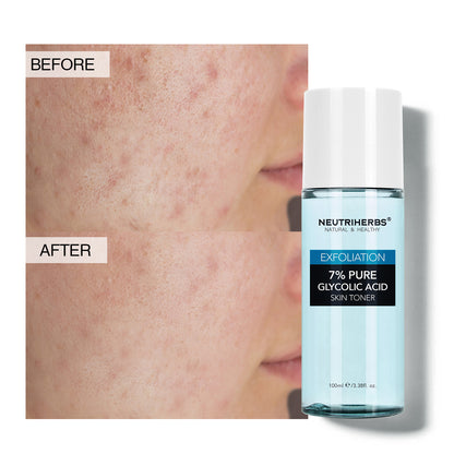 Private Label 7% Glycolic Acid Toner